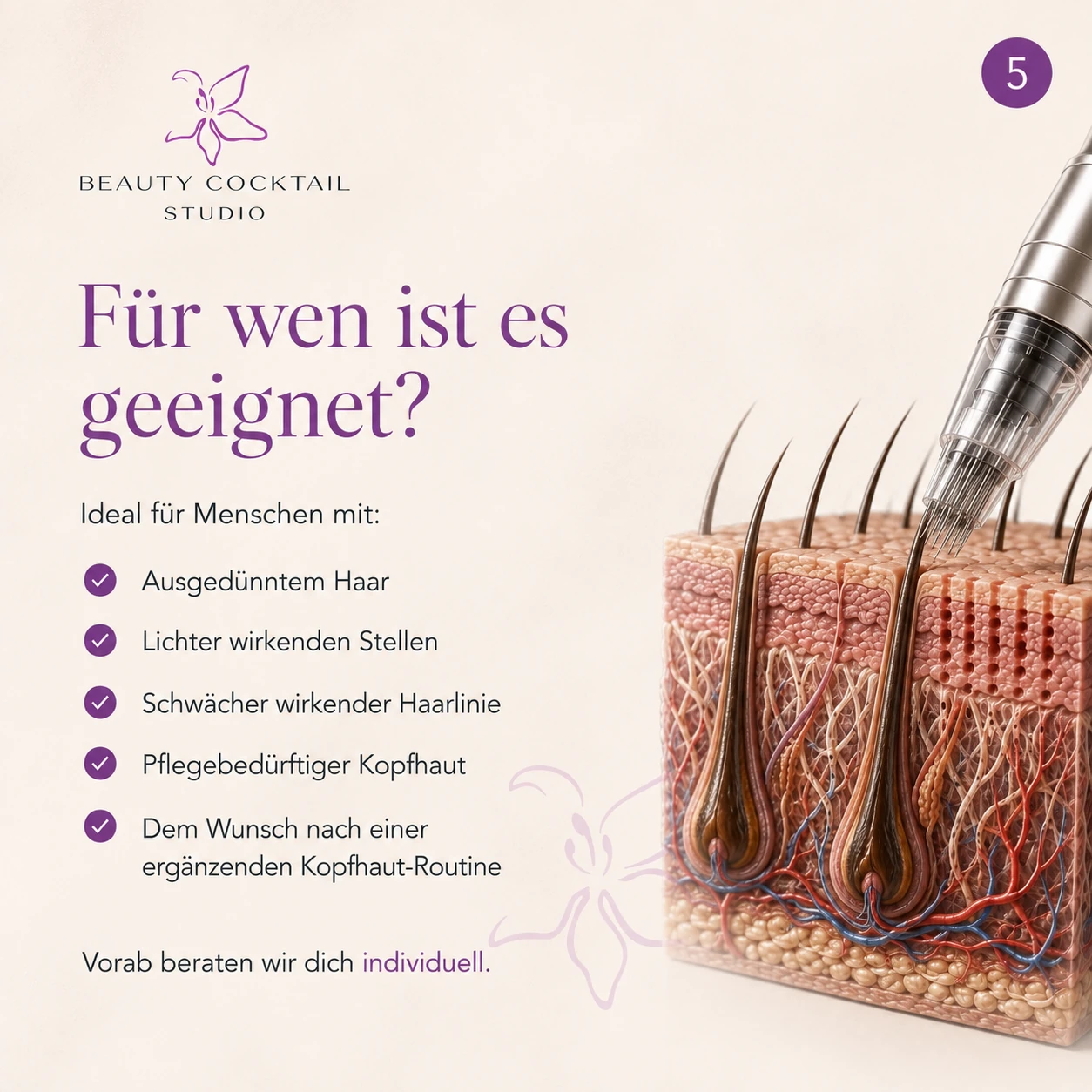 Für wen ist Microneedling der Kopfhaut geeignet