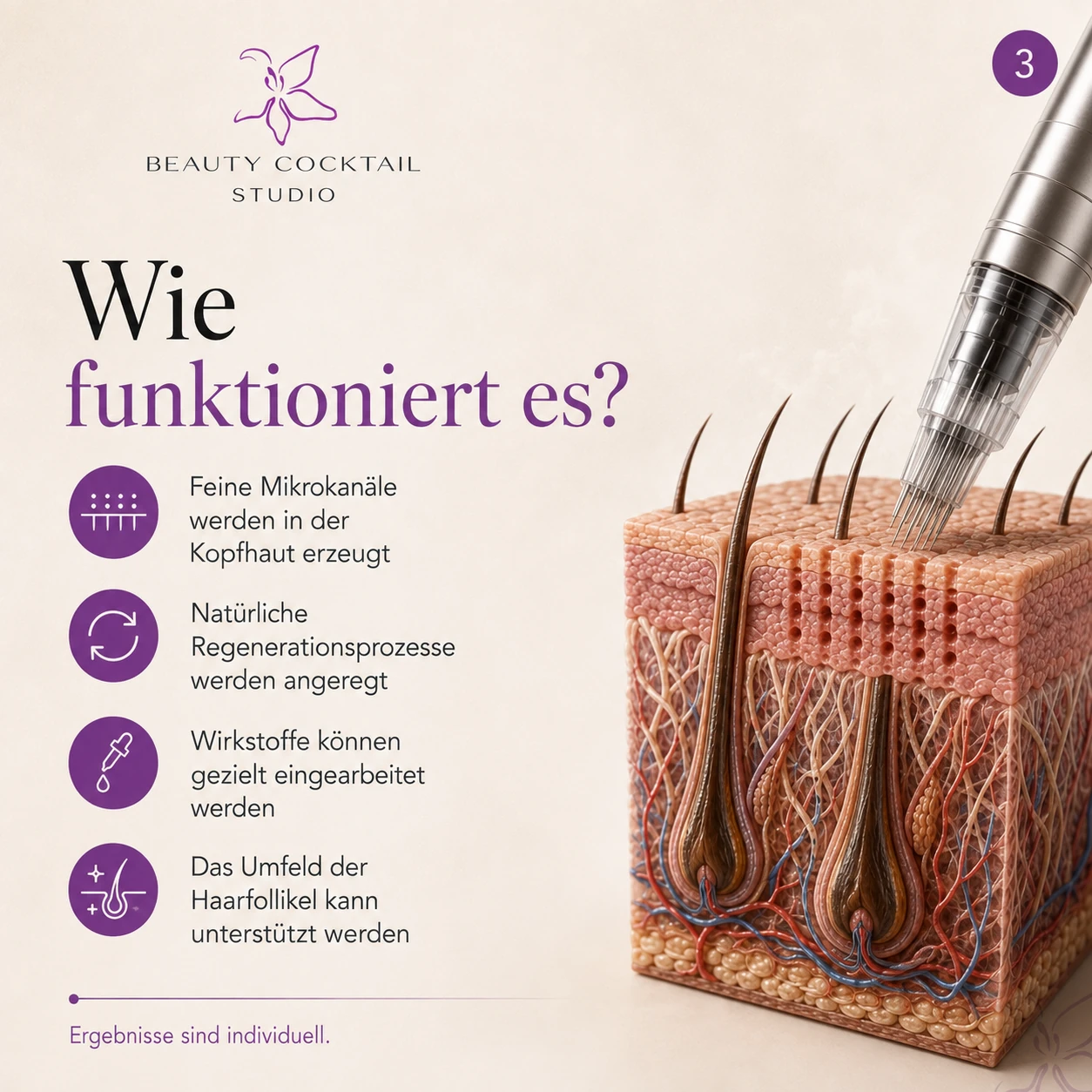 Infografik zur Wirkung von Kopfhaut-Microneedling